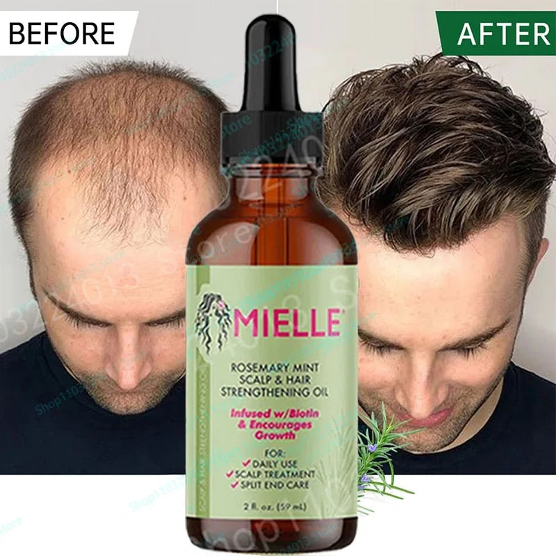 Mielle Rosemary Mint Hair Oil