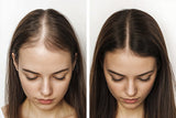 Kalwanji Shampoo - Sulfate-Free, & Dermatologically Tested CH6 Kalonji Shampoo