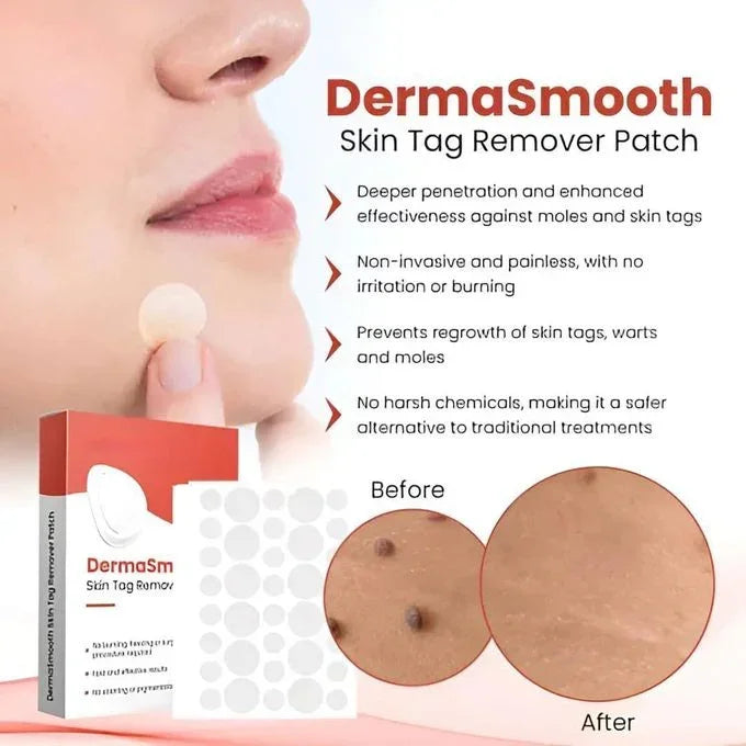 DERMA SMOOTH® SKIN TAG REMOVER PATCH - Pack of 100