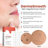 DERMA SMOOTH® SKIN TAG REMOVER PATCH - Pack of 100