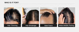 Bare Anatomy Hair Growth & Hair Fall Control Serum (30ml)