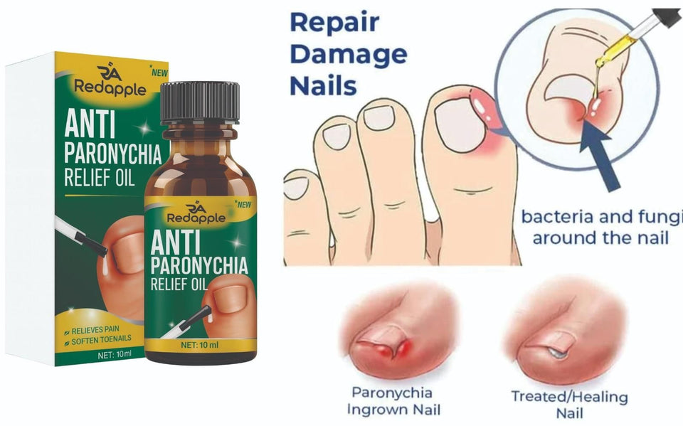 Anti Paronychia Relief Oil