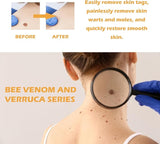 Ximonth Bee Venom Wart Cream