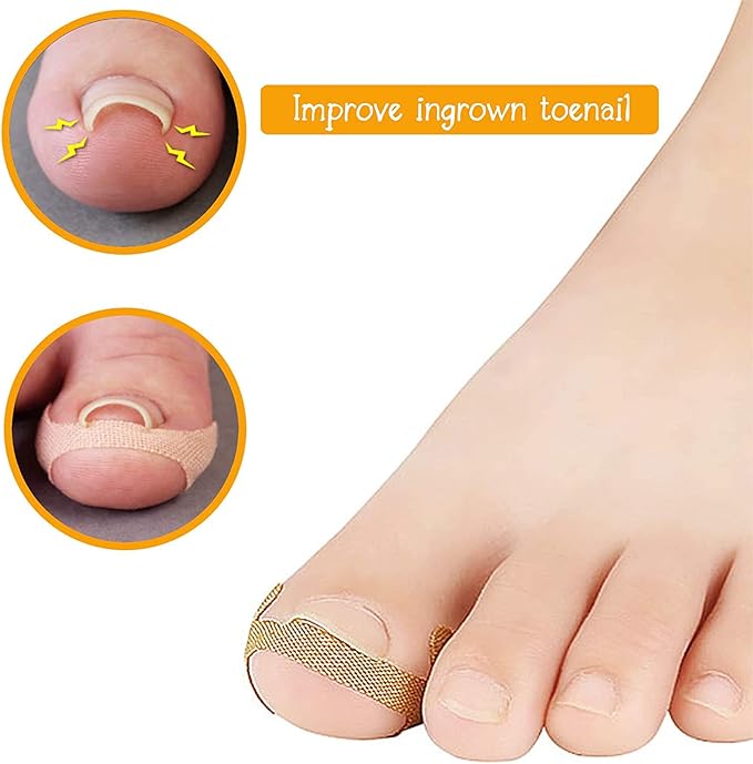 Ingrown Toenail Breathable Self-Adhesive Elastic Toenail Correction Patch