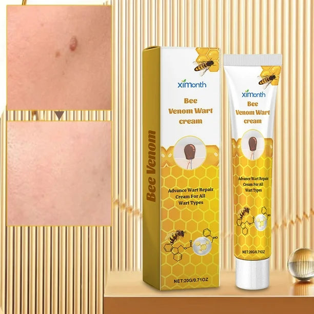 Ximonth Bee Venom Wart Cream