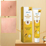Ximonth Bee Venom Wart Cream