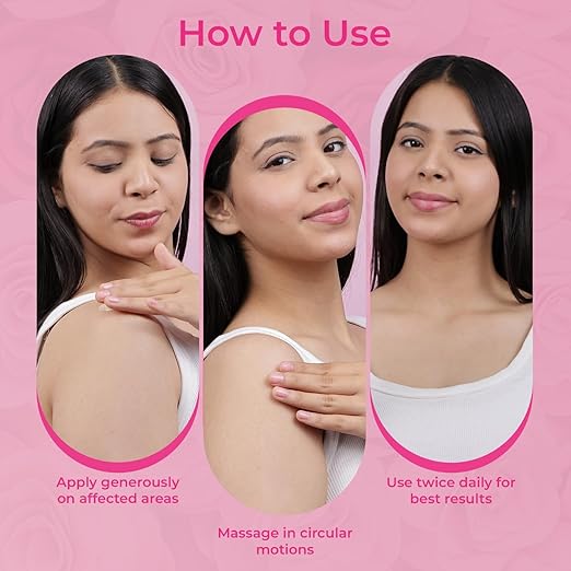 Strechmin Stretch Mark Cream for Women with Vitamin E