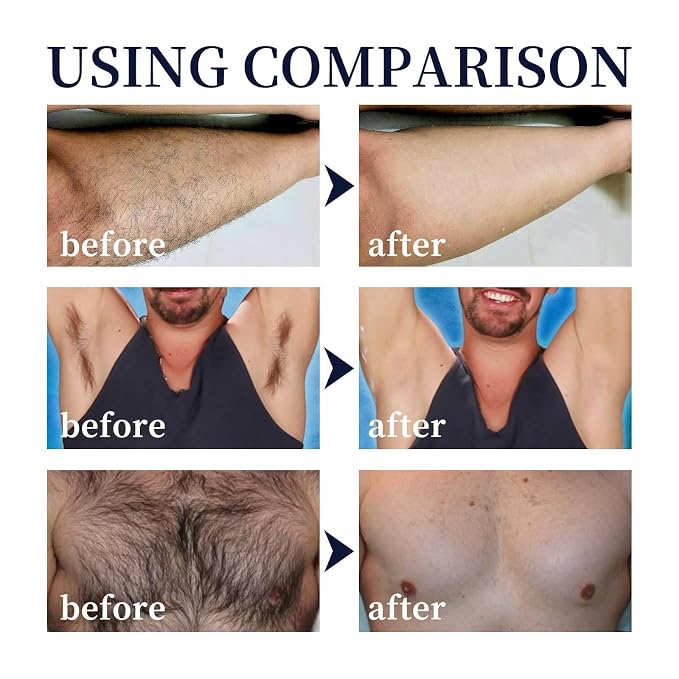 NNQ Hair Removal Spray for Sensitive Skin, Gentle Depilatory Foam for Women & Men