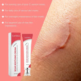 Skin Tag Remover Smooth Care Cream