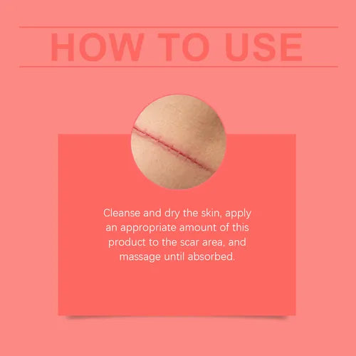 Skin Tag Remover Smooth Care Cream