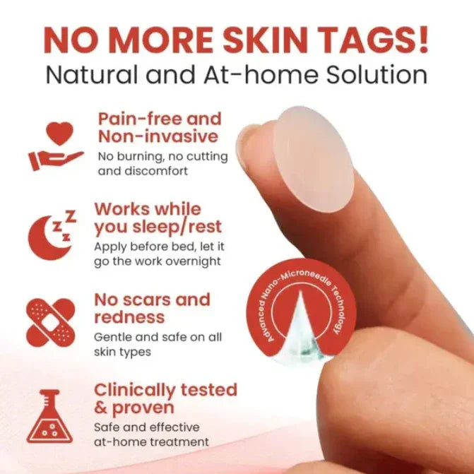 DERMA SMOOTH® SKIN TAG REMOVER PATCH - Pack of 100