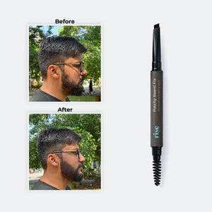 Patchy Beard Fix