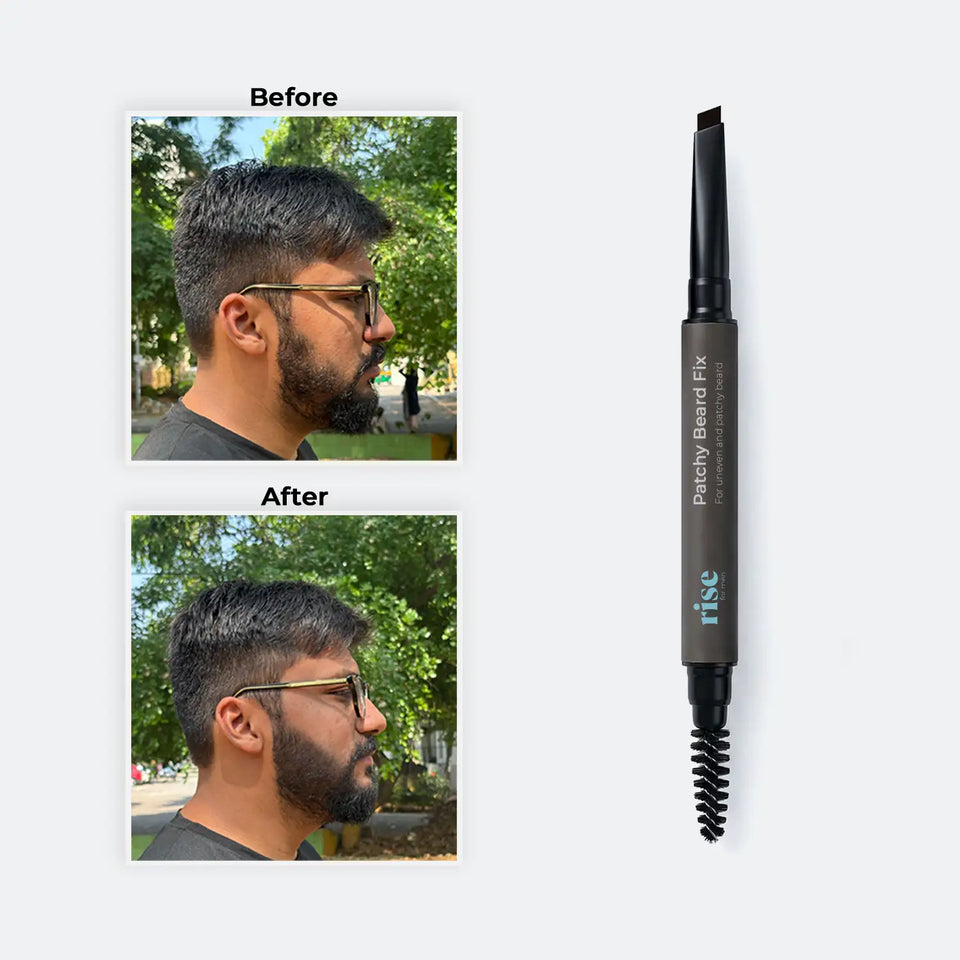 Patchy Beard Fix