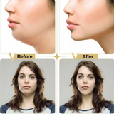 Double Chin Facial Slimming Strap