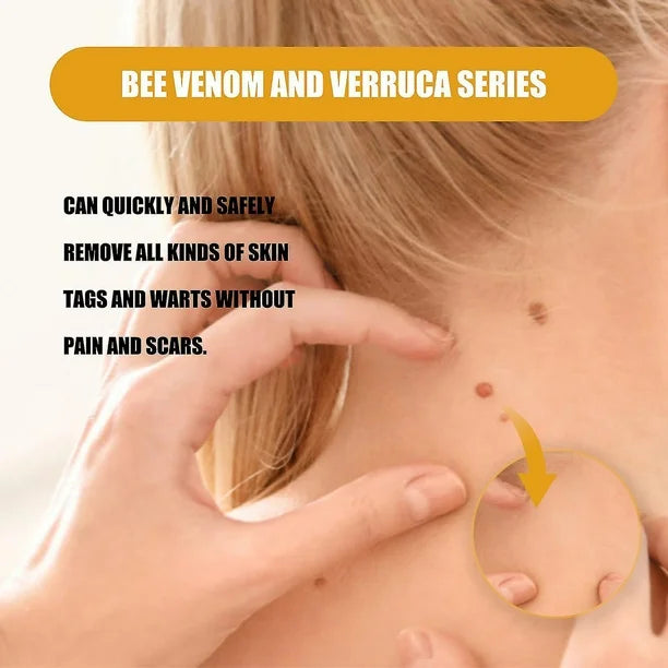 Ximonth Bee Venom Wart Cream