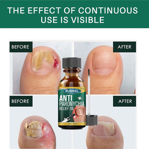 Anti Paronychia Relief Oil