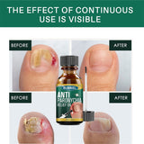 Anti Paronychia Relief Oil