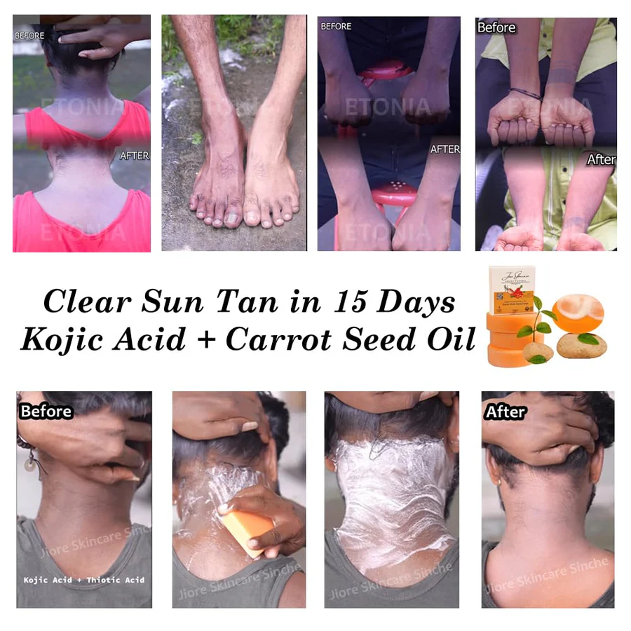 Kojic Skin Lightening Detan soap