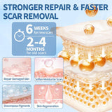 Professional Scar Removal Cream