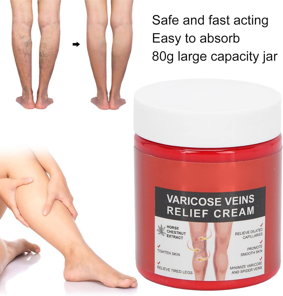 Varicose Veins Relief Cream