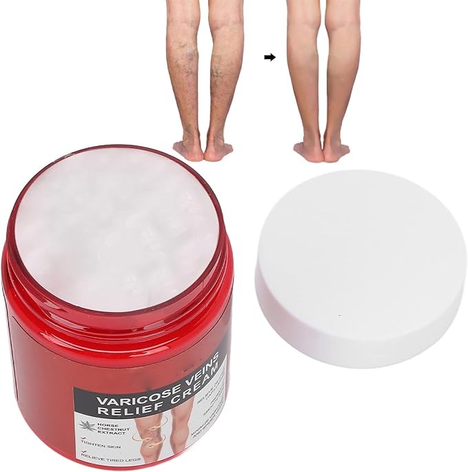 Varicose Veins Relief Cream