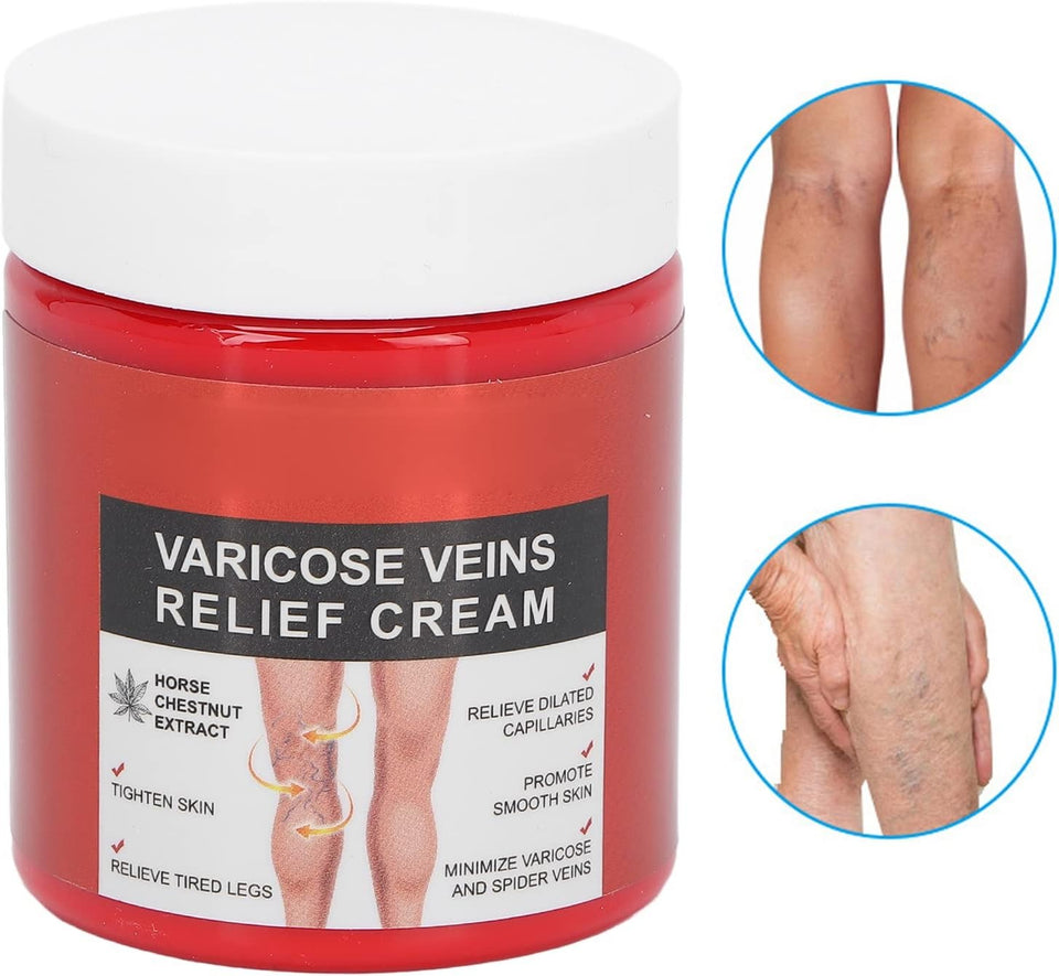 Varicose Veins Relief Cream