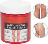 Varicose Veins Relief Cream