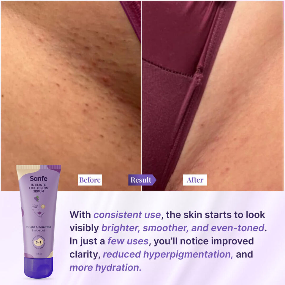 Intimate Lightening Serum