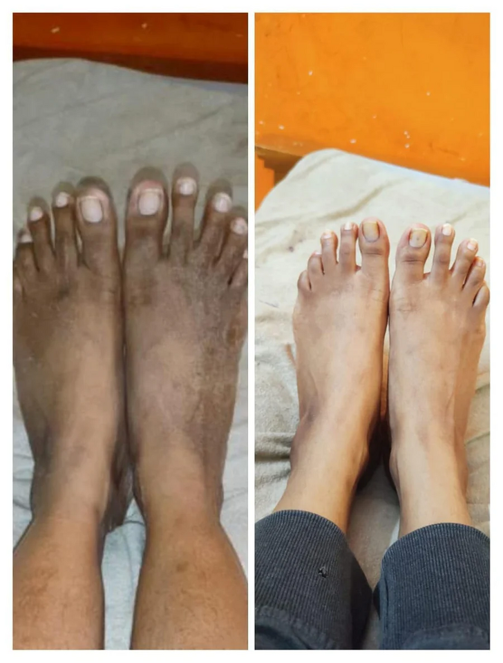 Kojic Skin Lightening Detan soap