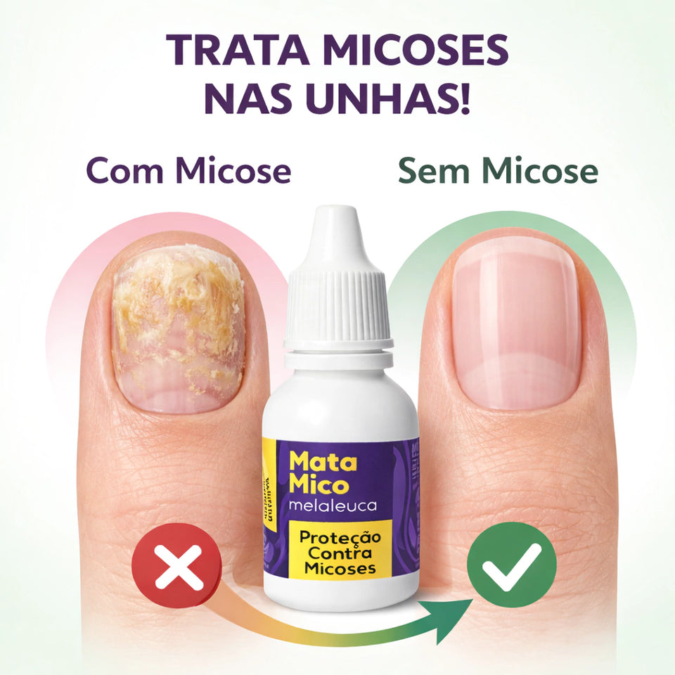 Cora 20ml MataMico Nail Oil Drops with Tea Tree Oil