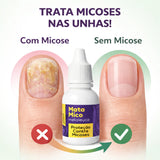 Cora 20ml MataMico Nail Oil Drops with Tea Tree Oil