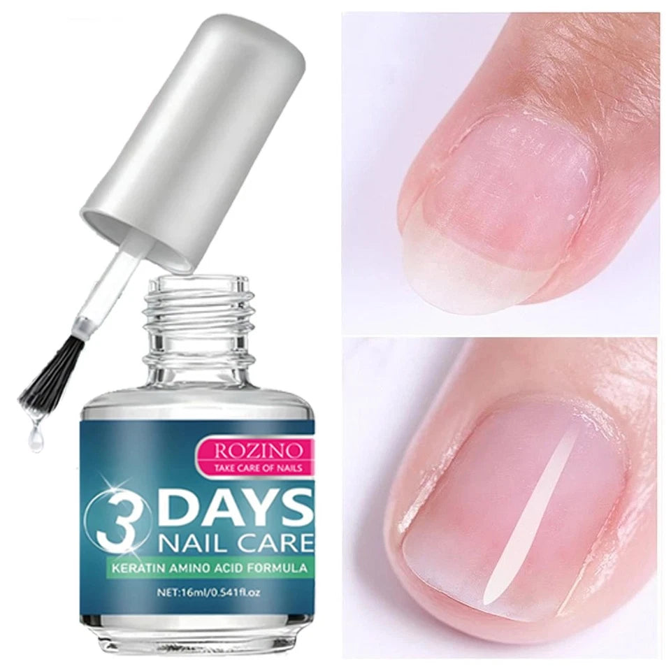 Keratin 3 Day Nail Growth Treatment, Keratin Amino Acid Nail Serum for Strengthener & Healthier Nails